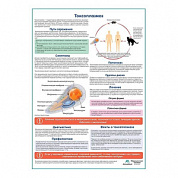 Токсоплазмоз медицинский плакат А1+/A2+ (матовый холст от 200 г/кв.м, размер A1+)