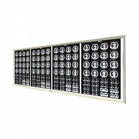 Негатоскоп LED на 4 снимка