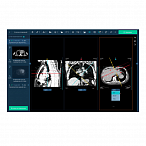 Информационная система АПК АрхиМед PACS/RIS