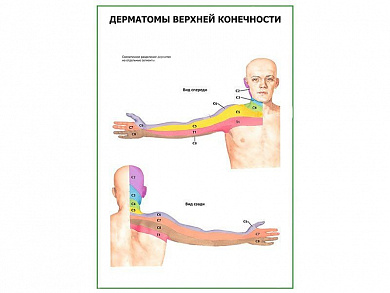 Дерматомы верхней конечности плакат глянцевый А1/А2 (глянцевый A2)