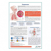 Пневмония медицинский плакат А1+/A2+ (глянцевый холст от 200 г/кв.м, размер A1+)