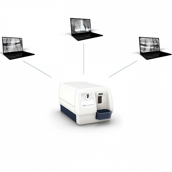 KaVo Scan eXam test drive Сканер фосфорных пластин. Высокая детализация изображения.