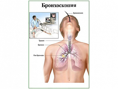 Бронхоскопия, плакат глянцевый А1/А2 (глянцевый A1)