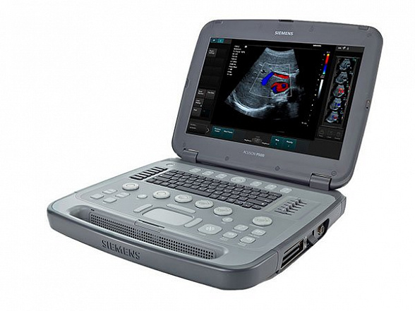 УЗИ Acuson P500 Siemens