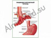 Пищеводно-желудочный переход плакат ламинированный А1/А2 (ламинированный	A2)