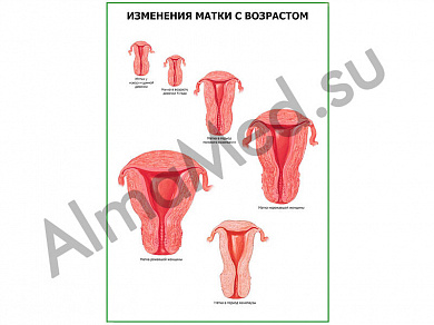 Возрастные изменения матки плакат глянцевый/ламинированный А1/А2 (глянцевый	A2)