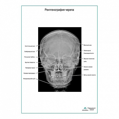 Рентгенография черепа плакат глянцевый А1+/А2+ (глянцевый холст от 200 г/кв.м, размер A1+)