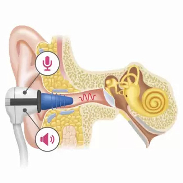 Портативный прибор для скрининга слуха "АСКРИН"