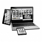 SuniRay2 - система компьютерной радиовизиографии, размер 1