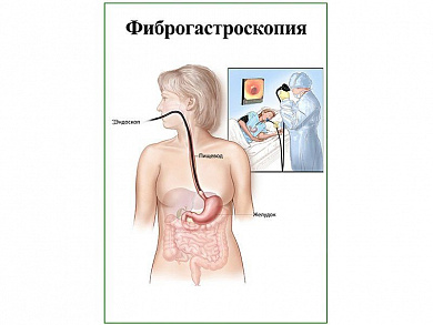 Фиброгастроскопия, плакат глянцевый А1/А2 (глянцевый A1)