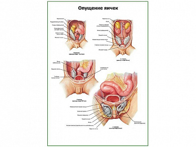 Опущение яичек плакат глянцевый А1/А2 (глянцевый A1)