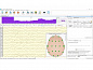 Комплекс для проведения тренингов Нейрон-Спектр-1/БОС, Нейрософт