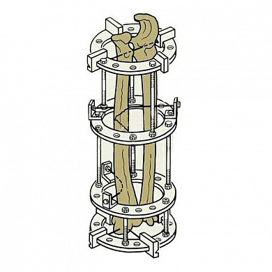 Комплект деталей аппарата Илизарова для плеча и предплечья