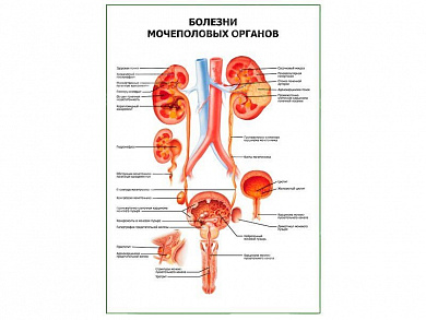 Болезни мочеполовых органов плакат глянцевый А1/А2 (глянцевый A1)