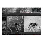 Томограф спектральный оптический когерентный, вариант исполнения: НОСТ-1, HUVITZ