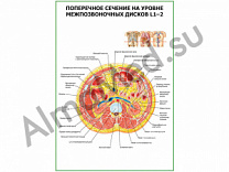 Поперечное сечение на уровне L1-2 плакат ламинированный А1/А2 (ламинированный	A2)