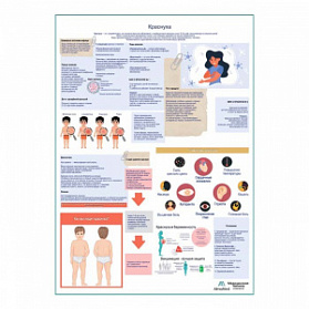 Краснуха, медицинский плакат А1+/A2+ (глянцевая фотобумага от 200 г/кв.м, размер A2+) Краснуха, медицинский плакат А1+/A2+ (глянцевая фотобумага от 200 г/кв.м, размер A2+)