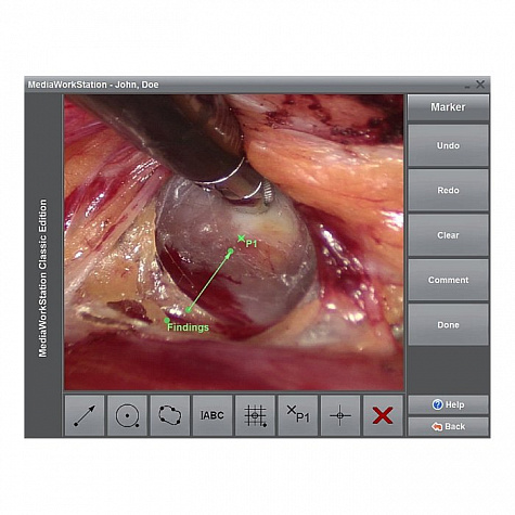 ПО для эндовидеокамер Dantschke MediaWorkStation 2.8 Classic