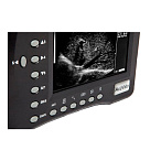 Портативный УЗИ сканер AcuVista RS880b