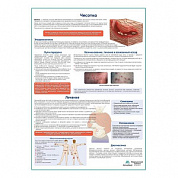 Чесотка медицинский плакат А1+/A2+ (глянцевый холст от 200 г/кв.м, размер A1+)