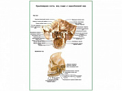 Крыловидная кость плакат глянцевый А1/А2 (глянцевый A1)