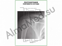Рентгенография плечевого сустава плакат ламинированный А1/А2 (ламинированный	A2)