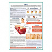 Оспа медицинский плакат А1+/A2+ (глянцевая фотобумага от 200 г/кв.м, размер A2+)