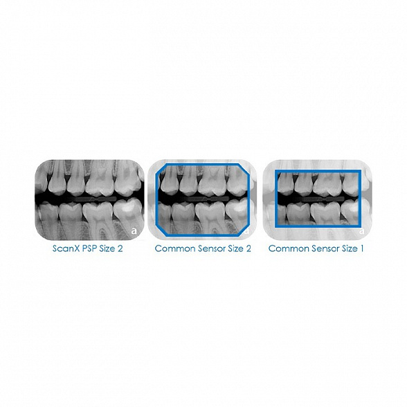 Air Techniques ScanX Duo - сканер для интраоральных снимков
