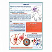 Лямблиоз медицинский плакат А1+/A2+ (глянцевый холст от 200 г/кв.м, размер A1+)