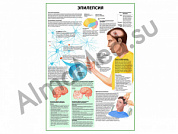 Эпилепсия плакат глянцевый/ламинированный А1/А2 (глянцевый A2)