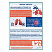 Вирусная пневмония медицинский плакат А1+/A2+ (матовый холст от 200 г/кв.м, размер A1+)