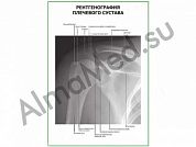 Рентгенография плечевого сустава плакат глянцевый/ламинированный А1/А2 (глянцевый	A2)