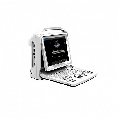 УЗИ сканер SonoTouch 20 Chison