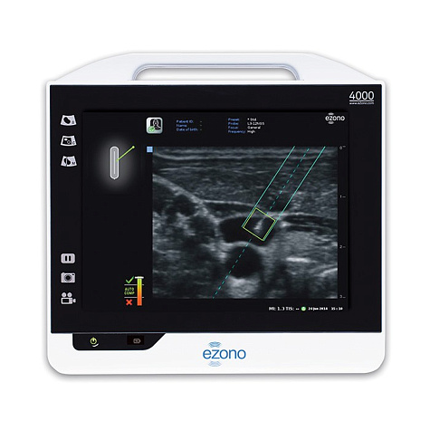 Аппарат УЗИ eZono 4000