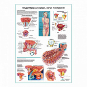Предстательная железа. Норма и патология, плакат глянцевый А1+/А2+ (глянцевая фотобумага от 200 г/кв.м, размер A1+)