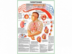 Гипертония плакат глянцевый А1/А2 (глянцевый A2)