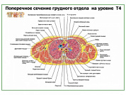 Поперечное сечение грудного отдела на уровне Т5-Т6 плакат глянцевый А1+/А2+ (глянцевый A1)