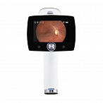 Ручная цифровая ретинальная камера AURORA, Optomed