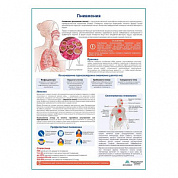 Пневмония медицинский плакат А1+/A2+ (матовый холст от 200 г/кв.м, размер A1+)