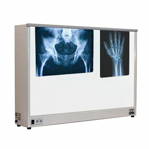 НС2-02-"ПОНИ" Негатоскоп двухкадровый, экран 430х700 мм