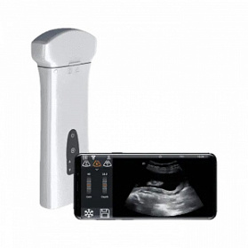 Беспроводная ультразвуковая система Delta 8 портативная Беспроводная ультразвуковая система Delta 8 портативная