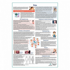 Корь медицинский плакат А1+/A2+ (глянцевая фотобумага от 200 г/кв.м, размер A2+) Корь медицинский плакат А1+/A2+ (глянцевая фотобумага от 200 г/кв.м, размер A2+)