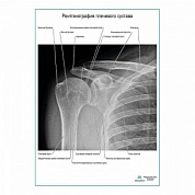 Рентгенография плечевого сустава плакат глянцевый  А1+/А2+ (глянцевая фотобумага от 200 г/кв.м, размер A2+)