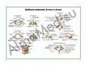 Шейные позвонки и их соединения плакат ламинированный А1/А2 (ламинированный	A2)
