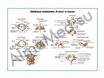 Шейные позвонки и их соединения плакат ламинированный А1/А2 (ламинированный	A2)