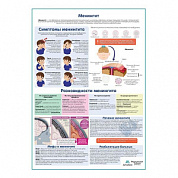 Менингит медицинский плакат А1+/A2+ (глянцевый холст от 200 г/кв.м, размер A1+)