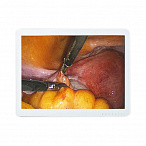 Монитор для эндоскопа 19 дюймов Huger