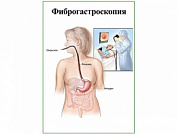 Фиброгастроскопия, плакат глянцевый А1/А2 (глянцевый A1)