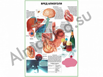 Вред алкоголя плакат ламинированный А1/А2 (ламинированный	A2)