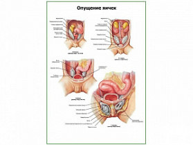 Опущение яичек плакат глянцевый А1/А2 (глянцевый A1)